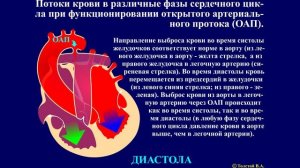 Тема 45.3. Врожденные пороки сердца – открытый артериальный проток (ОАП)