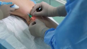 Инновационная методика - лазерная коагуляция