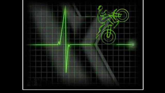 "Реанимационная цыганочка". Шевалье. смотреть онлайн