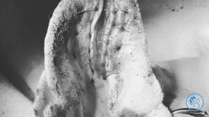 Отогематома у собаки