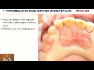 Особенности адаптации пациентов к съемным протезам. Рекомендации по уходу за съемными зуб. протезами