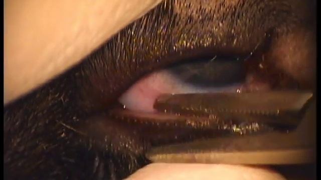 нормальная функция мейбомиевых желез(пример) смотреть онлайн