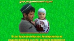 Чудо ребенок. ДАГЕСТАН. ФИЛЬМ ( islamdag.ru )