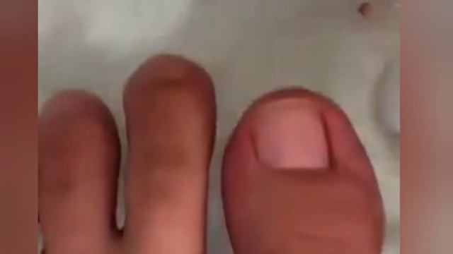 Very lovely cut and clean nails reducing broken skin смотреть онлайн