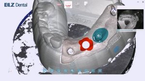 Сканирование с одним сканбоди BLZ LS100