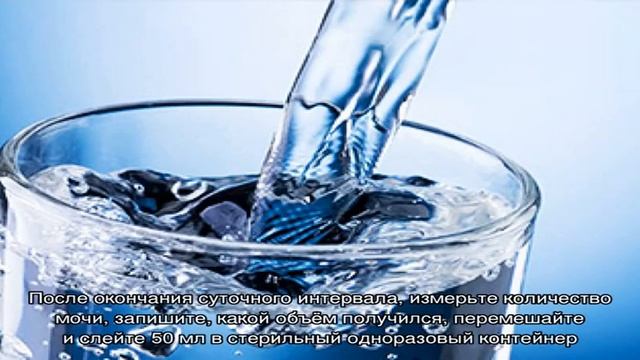 Кристаллы мочевой кислоты в моче