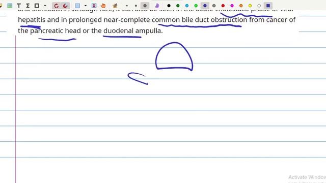 Focused History: Jaundice смотреть онлайн