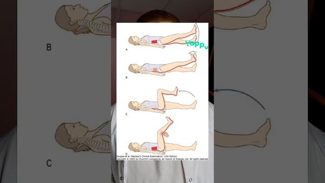 Как распознать грыжу в спине? #медицина #медбрат