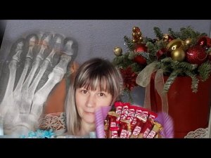 Покупки, подарки, перелом Часть первая