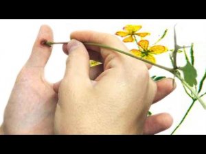 Лечение чистотелом