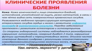 Методы лечения ларингита у ребенка в домашних условиях
