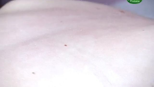 Сорока62.Линия жизни.ГУЗ Ряз.обл.консультативно-диагностический центр, Еламед, аптека"Спрей" смотреть онлайн