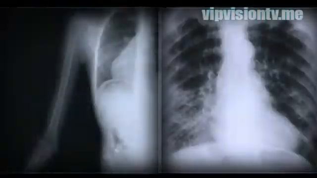 Защита от радиации - Di Guard nano_ru смотреть онлайн