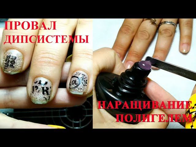 Полный провал дипсистемы! Наращивание полигелем.