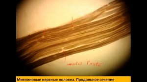 МИЕЛИНОВОЕ ВОЛОКНО | Разбор гистологического препарата