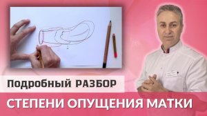 Опущение Матки. Подробное видео о трех степенях опущения матки