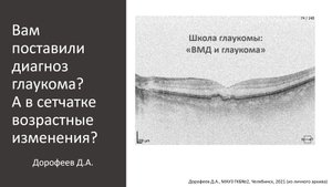 Школа глаукомы. Глаукома и заболевания сетчатки