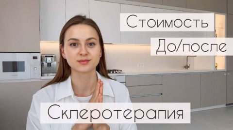 Склеротерапия после беременности | Как избавиться от сосудистых звездочек навсегда?