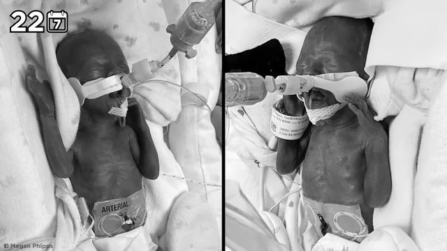 Необычные Случаи Беременности смотреть онлайн