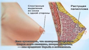 «Сонник Сосок приснился, к чему снится во сне Сосок»
