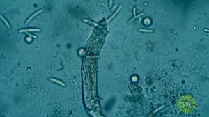 Прокариоты и эукариоты.