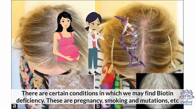 Biotin for Hair Growth смотреть онлайн