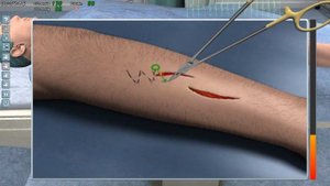 Chirurgie Simulator Gameplay E5200 + 9800 GT + 2 GB RAM HD