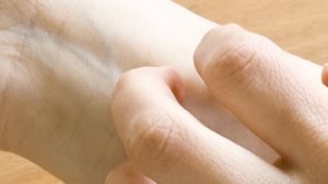 Что делать, если чешиться тело, без видимых причин.