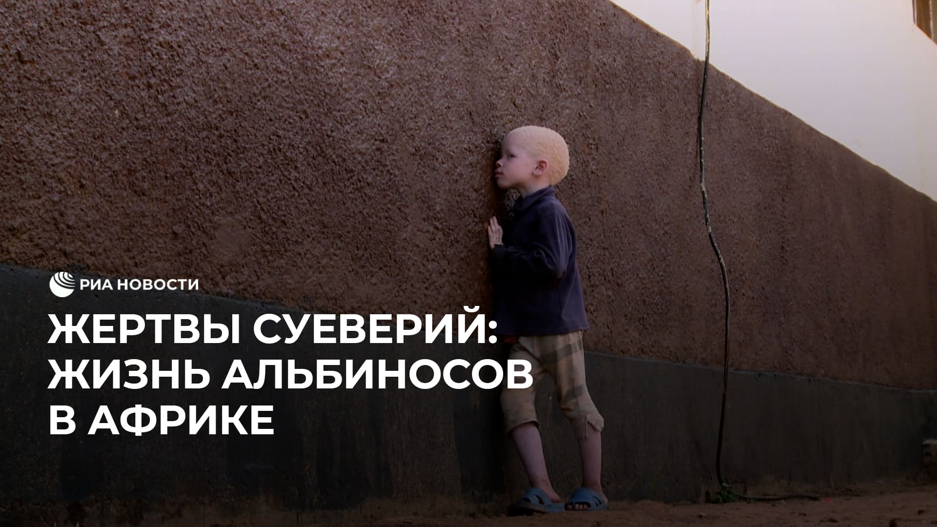 Жизнь альбиносов в Африке