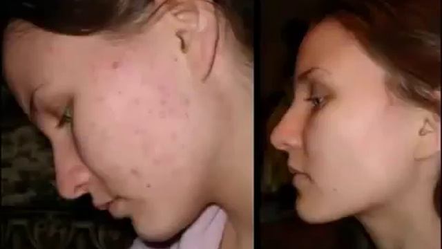 Смотреть Диета Как Убрать Живот И Бока Быстро Как Правильно Похудеть И Избавиться От Живота1 смотреть онлайн