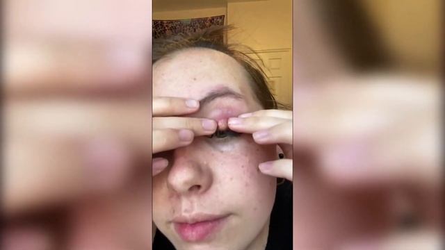 МОРЕ ВЗРЫВАЮЩИЕСЯ ПРЫЩЕЙ! ЗАЛИПАТЕЛЬНОЕ РАССЛАБЛЯЮЩЕЕ ВИДЕО!
