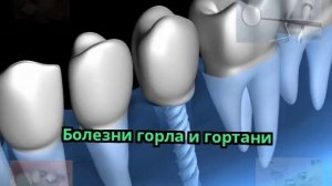 Болезни горла и гортани