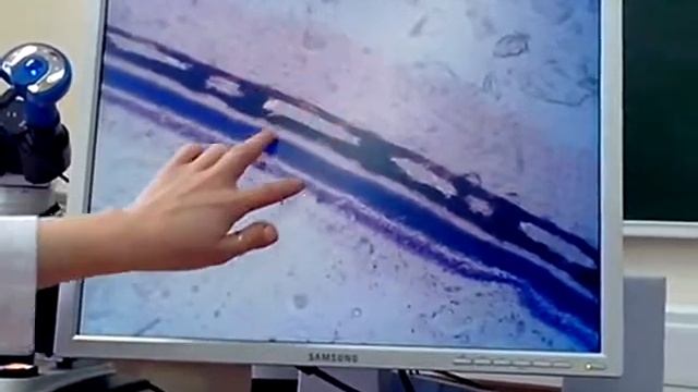 Гистология Задняя стенка глаза Роговица [Нервная система] смотреть онлайн