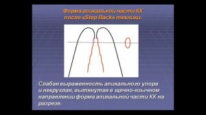 12:00 Основы эндодонтии