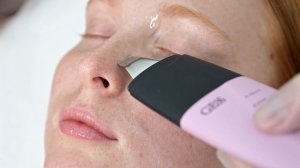 Как избавиться от чёрных точек на носу в домашних условиях. Новая уз-чистка Charme в действии