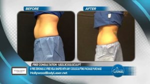 Hollywood Body Laser Center: Call for a Free Consultation