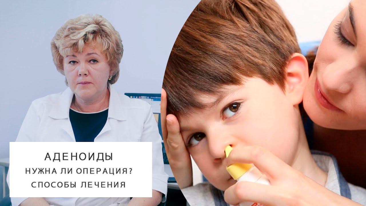 АДЕНОИДЫ | Нужна ли операция? | Способы лечения смотреть онлайн