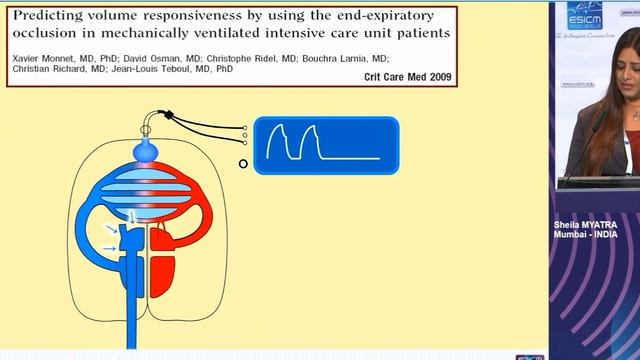 Prediction of fluid responsiveness Sheila Myatra
