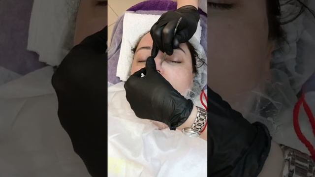Комбинированная чистка лица у косметолога