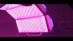 Фотодинамическая терапия