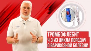 Тромбофлебит и варикоз на ногах.