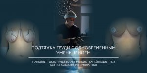 Якорная мастопексия и редукция груди