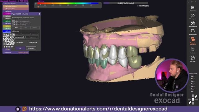 Exocad Stream / Reditive Compensation / VoxelDance Additive / HTML To STL/ Разбор работ