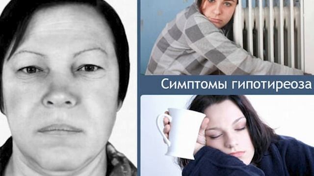 Диагноз гипотиреоз - не приговор! (Ответы на Вопросы)