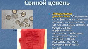 Свиной цепень