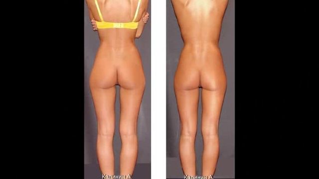 ЦЕНТР КОРРЕКЦИИ ФИГУРЫ