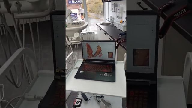 Использование внутриротового сканера