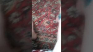 Перелом двух лодыжек со смещением 8 неделя