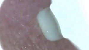 Первая чистка ушей с помощью умной ушной палочки Bebird X17 Pro!