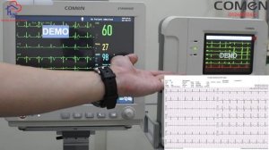 COMEN Patient Monitor Star8000F and ECG 12 Channels